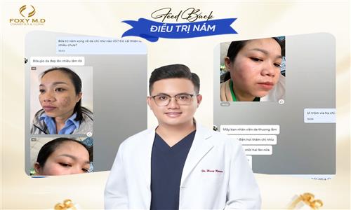 Feedback trị nám tại Foxy có thật sự hiệu quả không?