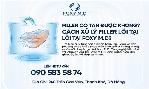 Filler có tan được không? Cách xử lí lỗi filler tại FoxyMD