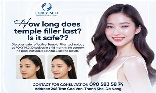 How Long Does Temple Filler Last, and Is It Safe?