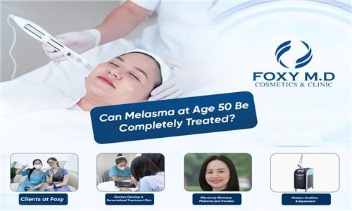 Is it possible to completely cure melasma at the age of 50?