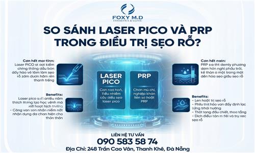 So sánh laser pico và prp trong điều trị sẹo rỗ? Lựa chọn nào tốt?