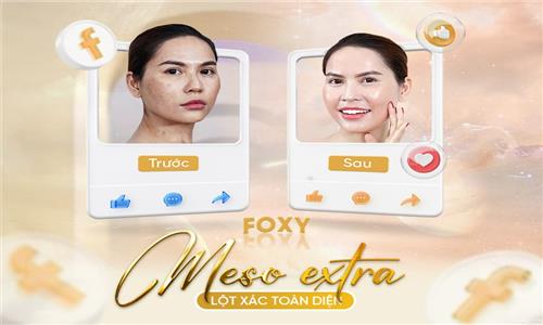 Tiêm Meso giữ được bao lâu và phụ thuộc vào yếu tố nào?