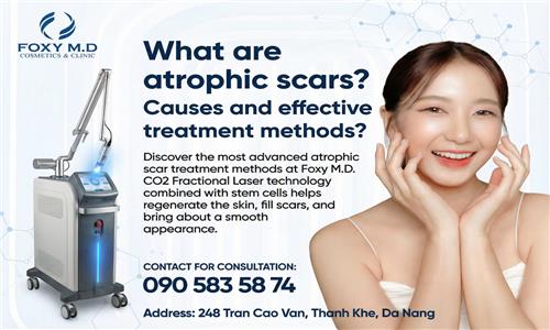 Common Acne Scar Treatment Methods Today