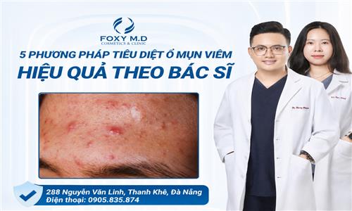 Dịch vụ trị mụn chuyên sâu tại Foxy Đà Nẵng