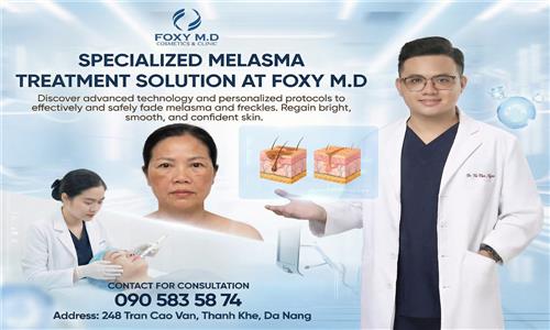 Advanced Melasma Treatment Solutions at Foxy MD