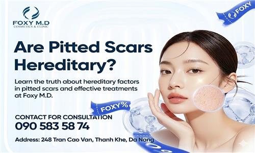 Are pitted scars hereditary in Da Nang? The truth few people know.