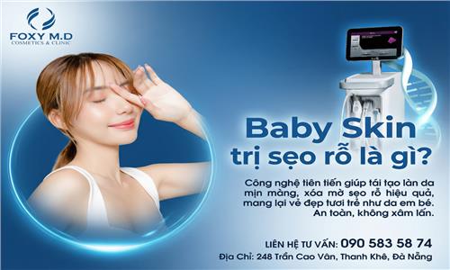 Baby Skin trị sẹo rỗ là gì?
