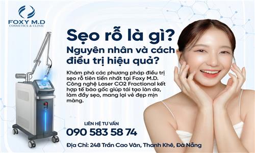 Các phương pháp điều trị sẹo rỗ phổ biến hiện nay