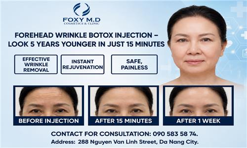 Can Botox injections remove forehead wrinkles and make you look 5 years younger in just 15 minutes?