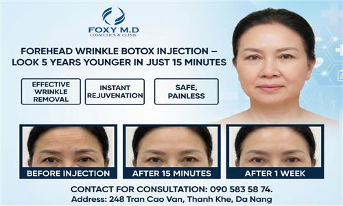 Can Botox injections remove forehead wrinkles and make you look 5 years younger in just 15 minutes?