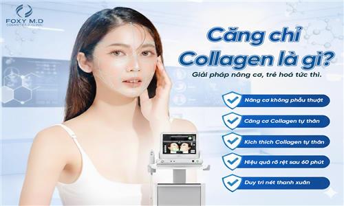 Căng Chỉ Collagen Có An Toàn Không? Giải Mã 
