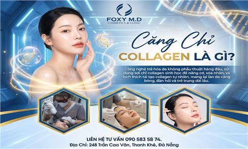 Căng Chỉ Collagen Là Gì? Tất Tần Tật Điều Các Bạn Cần Biết