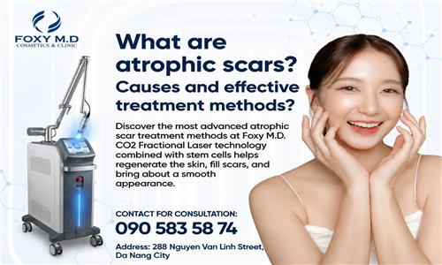 Common Acne Scar Treatment Methods Today