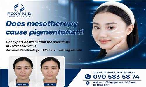 Does melasma treatment with melasma cause recurrence? Expert Foxy answers this question.