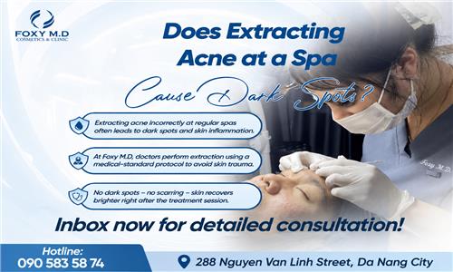 DOES PIMPLE EXTRACTION AT SPAS IN DA NANG LEAVE SCARS/DARK SPOTS? DOCTOR ANSWERS