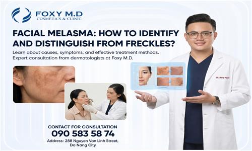 Facial Melasma: How to Identify and Differentiate It from Freckles