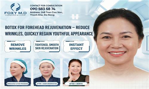 Forehead Rejuvenation with Botox – Reduce Wrinkles and Restore a Youthful Appearance Quickly