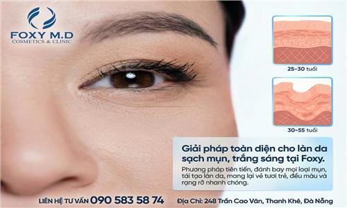 Giải pháp toàn diện cho làn da sạch mụn trắng sáng tại Foxy là gì?