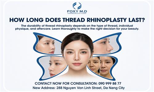 How Long Does Thread Nose Lifting Last and What Does It Depend On?
