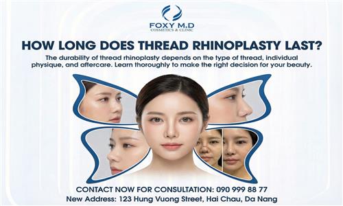 How Long Does Thread Nose Lifting Last and What Does It Depend On?