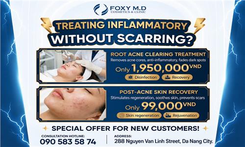 How to treat inflammatory acne without leaving scars? Scientific tips for smooth skin
