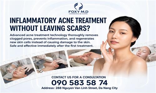 Inflammatory acne treatment without scarring: The secret to smooth skin