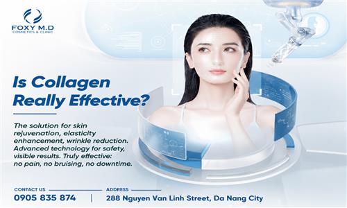 Is Collagen Thread Lifting Effective? Unveiling the Truth About This 