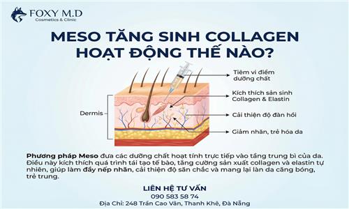 Meso tăng sinh collagen hoạt động như thế nào ? Giải đáp từ chuyên gia