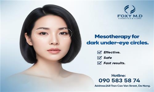 Mesotherapy for dark circles under the eyes in Da Nang: The solution to 