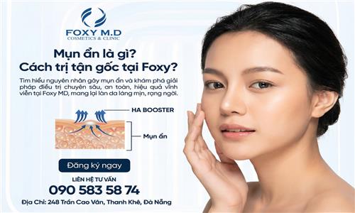 Mụn ẩn là gì cách trị tận gốc tại foxy ? Bí kíp cho làn da mịn màng