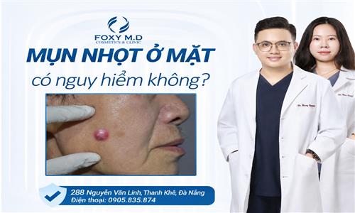 Mụn nhọt ở mặt có nguy hiểm không?