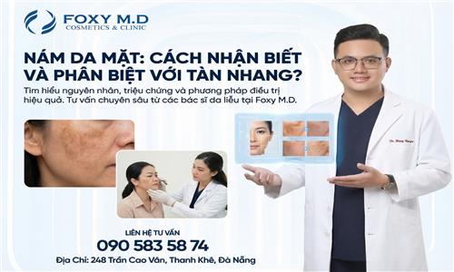 Nám da mặt cách nhận biết và phân biệt với tàn nhan?