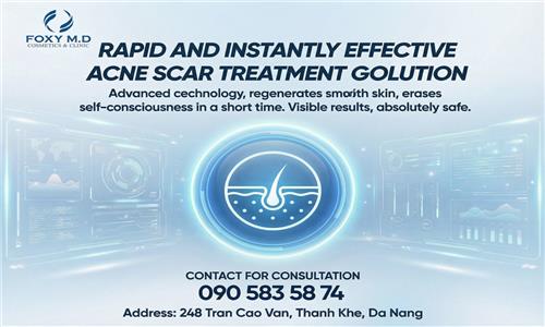 Quick and Instantly Effective Solutions for Acne Scar Treatment