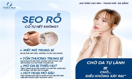 Sẹo Rỗ Có Tự Hết Không? Giải Pháp Điều Trị Chuẩn Y Khoa Tại Foxy MD