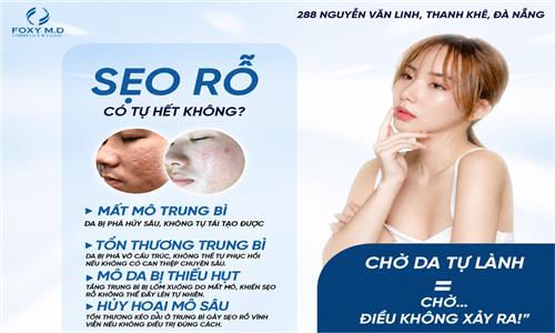 Sẹo Rỗ Có Tự Hết Không? Giải Pháp Điều Trị Chuẩn Y Khoa Tại Foxy MD