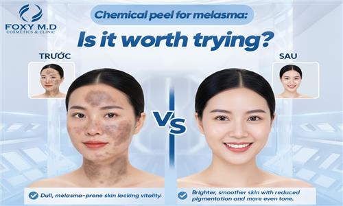 Should You Try a Skin Peel for Hyperpigmentation? Unspoken Advice from Experts