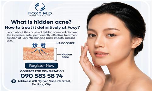 What is hidden acne and how to treat it permanently at Foxy?