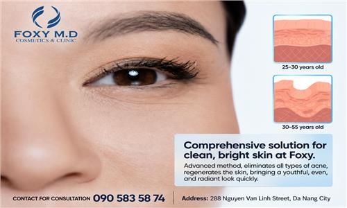 What Is the Comprehensive Solution for Clear, Acne-Free, and Radiant Skin at Foxy?
