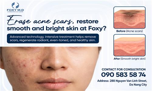 What Is the Solution for Fading Acne Dark Spots and Restoring Bright, Smooth Skin at Foxy?