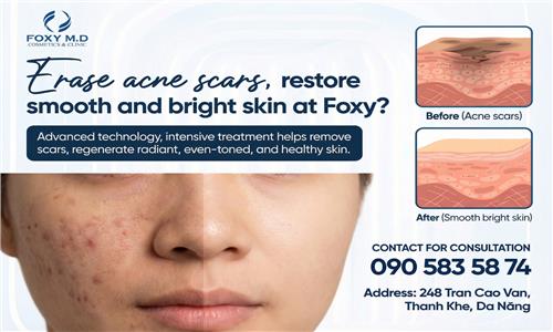 What Is the Solution for Fading Acne Dark Spots and Restoring Bright, Smooth Skin at Foxy?