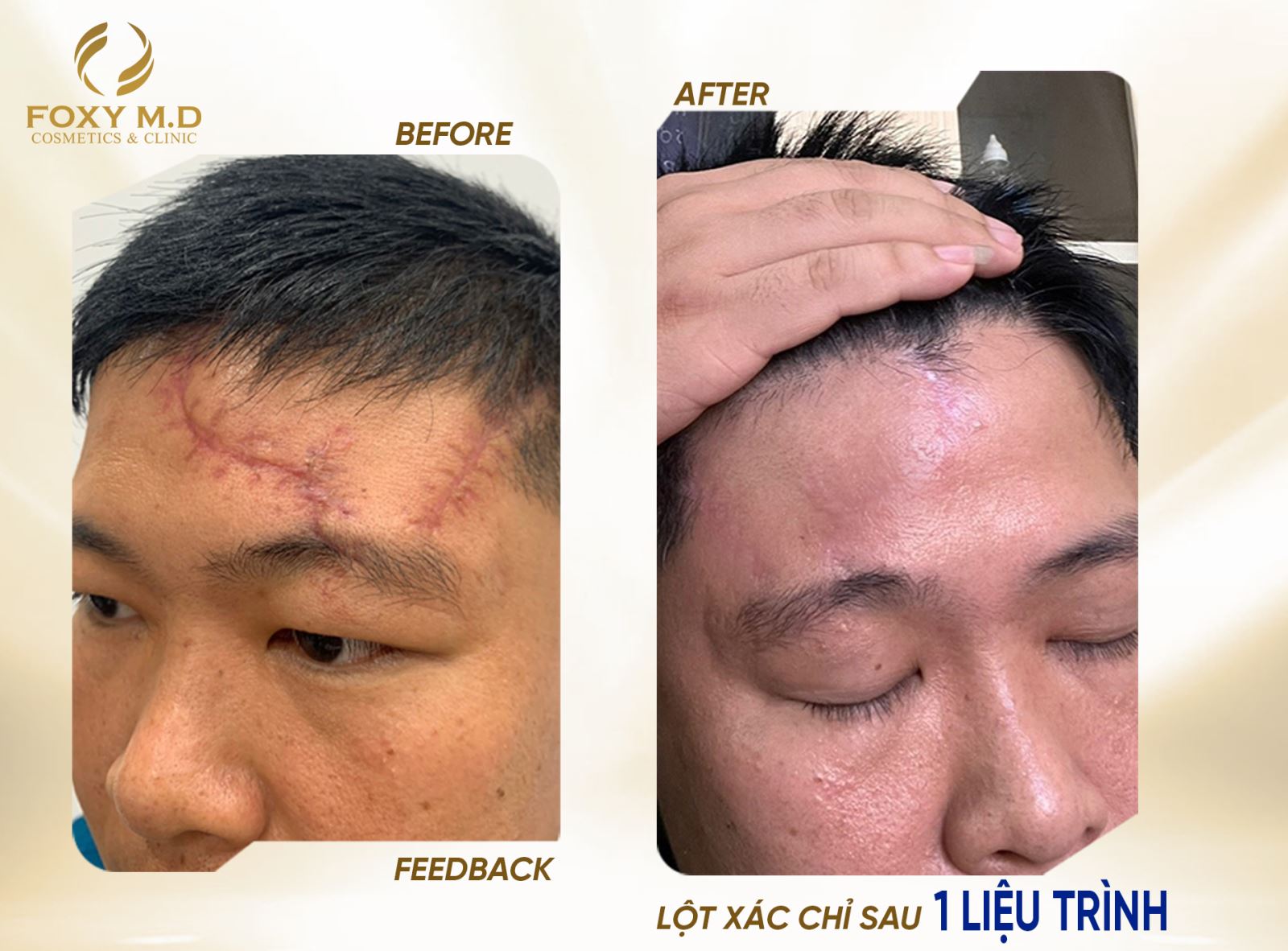 Giải pháp hiệu quả cho làn da mịn màng