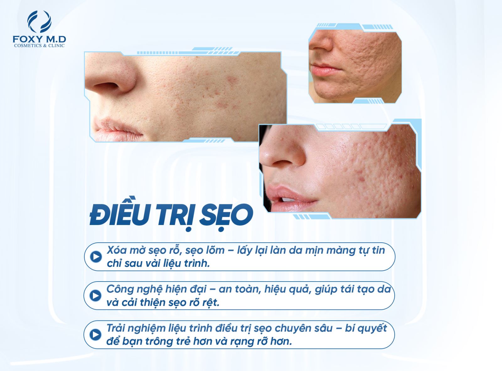 Điều trị sẹo hiệu quả – Giải pháp lấy lại làn da mịn màng tự tin