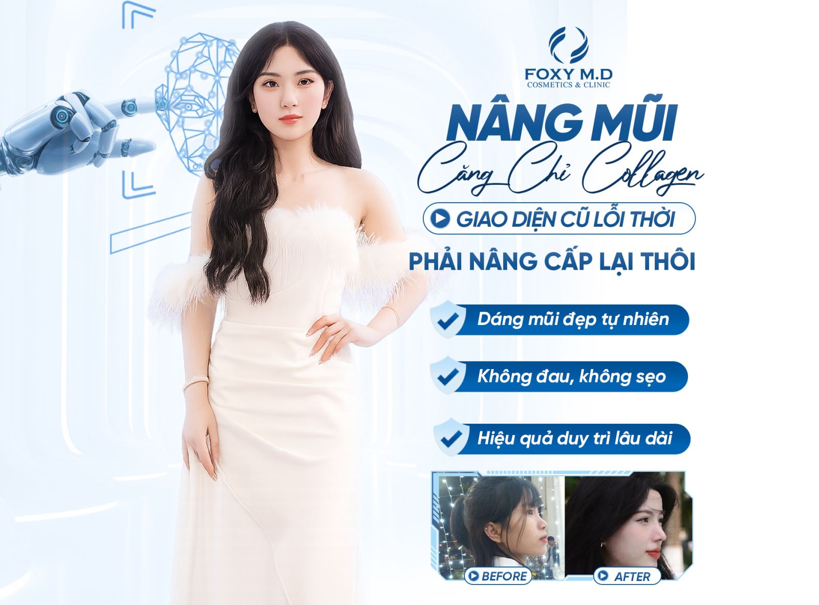 Nâng mũi chỉ collagen – Bí quyết dáng mũi đẹp tự nhiên