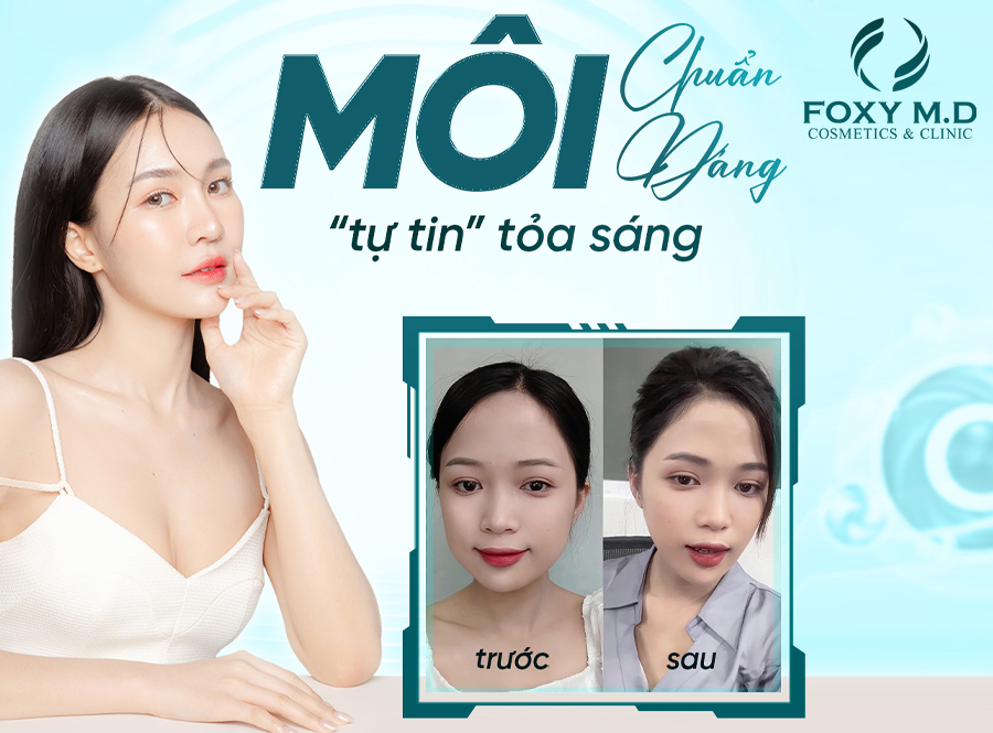 Môi Chuẩn Dáng, Tự Tin Chuẩn Sáng – Bí Quyết Nâng Tầm Vẻ Đẹp