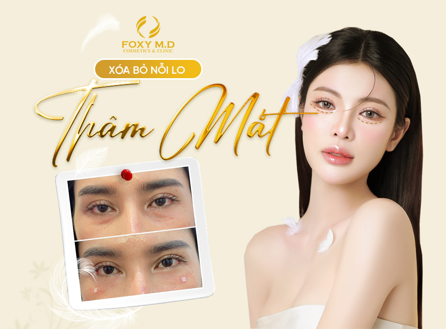 Trị Thâm Mắt Hiệu Quả Bằng Skinbooster