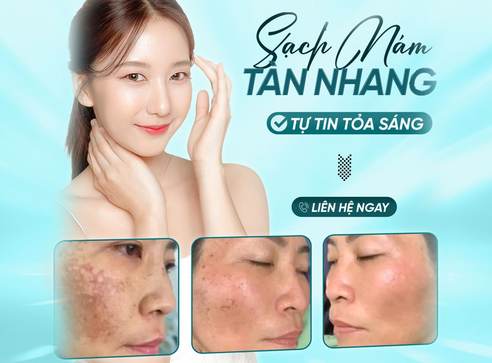 Bí quyết sở hữu làn da sạch nám tàn nhang tự tin tỏa sáng