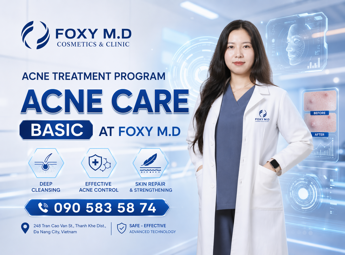 Basic Facial Acne Package in Da Nang — Mild Acne Control & Regular Skin Cleansing at Foxy M.D Clinic