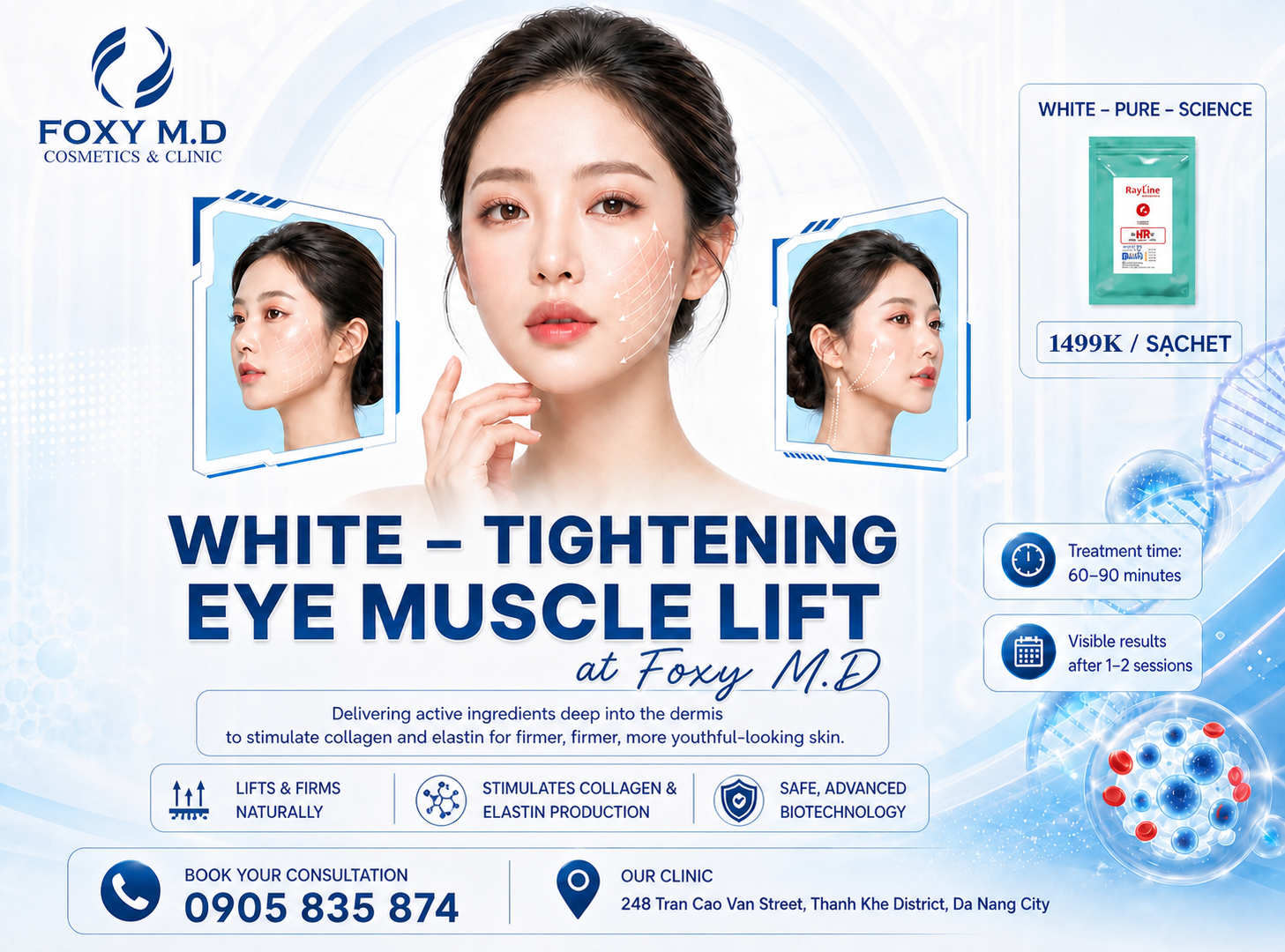 PDO Cog Thread Lift in Da Nang — Medical-Grade Facial Lifting with Polydioxanone Threads at Foxy M.D Clinic