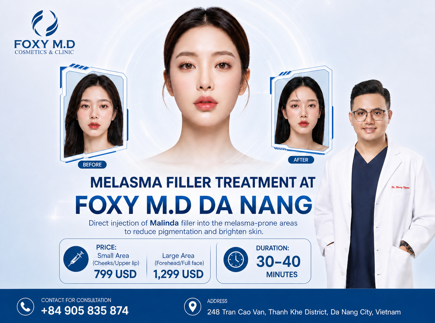 White Thread Lift in Da Nang — Non-Surgical Facial Lifting with Bioresorbable Threads at Foxy M.D Clinic