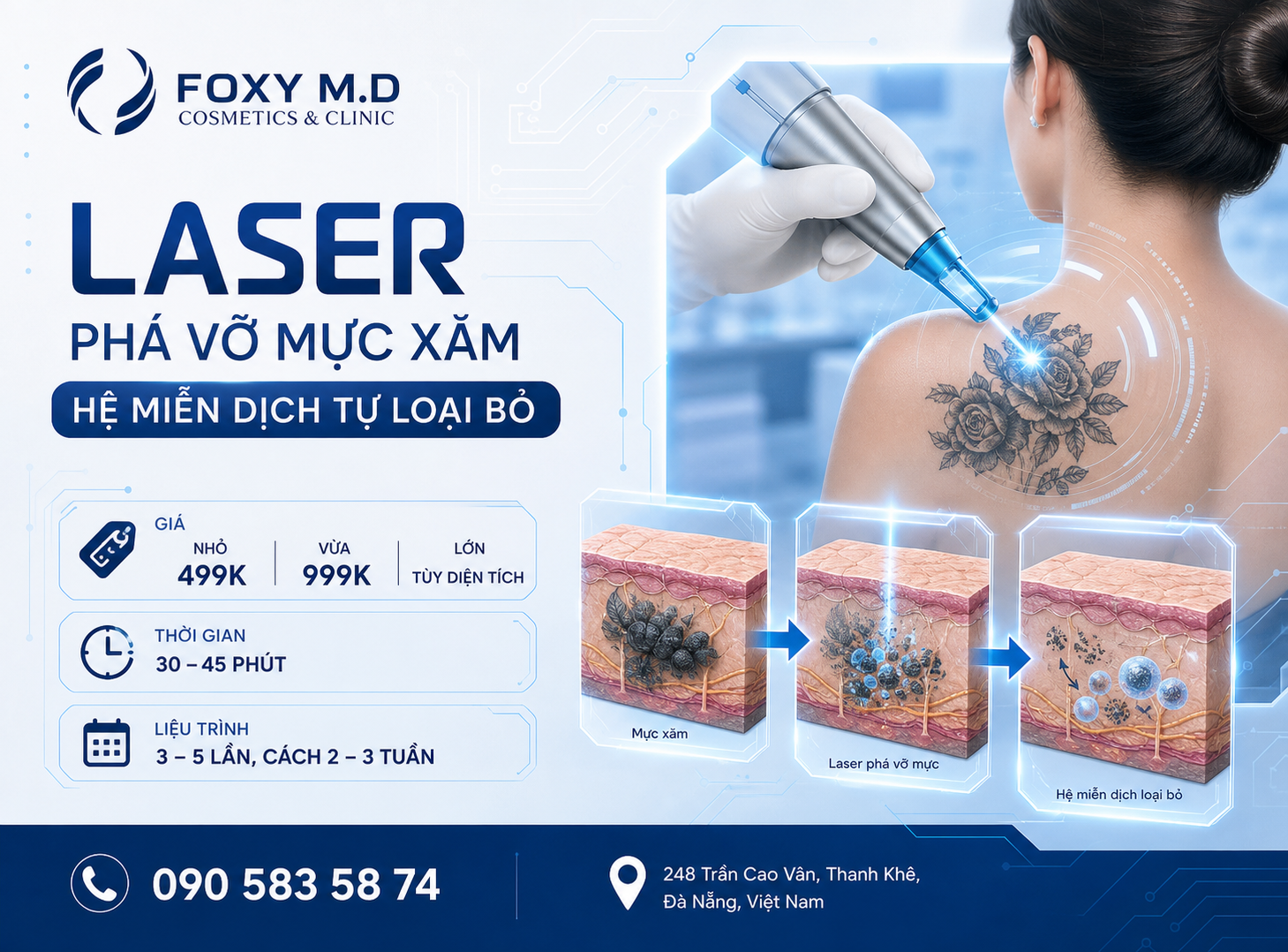 Xóa Xăm Laser Đà Nẵng — Công Nghệ Pico & Q-Switch Tại Foxy M.D Clinic